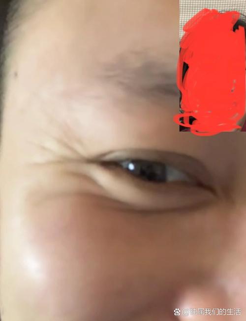 现代社会出轨频发，鱼尾纹竟能看出婚姻长短？(图3)