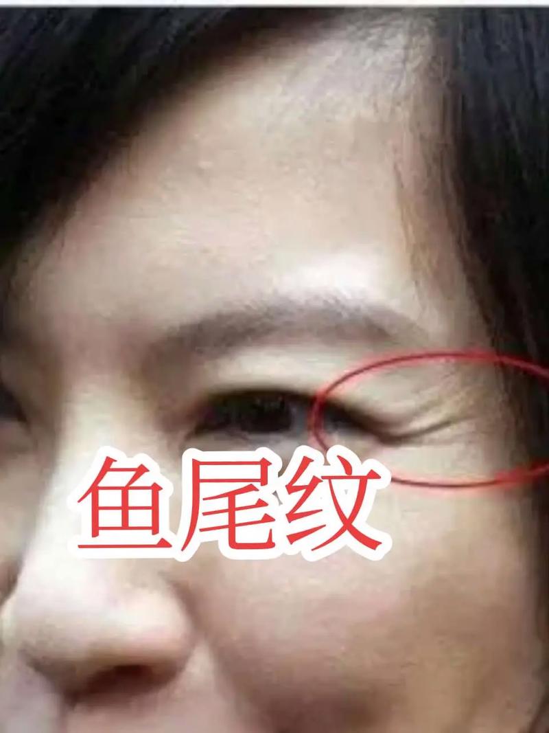 鱼尾纹面相大揭秘：不仅关乎衰老，还藏别样寓意？(图2)